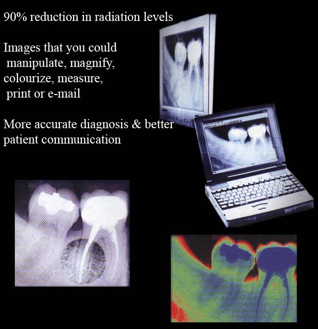 digital radiography in goa by dr anil dasilva