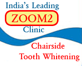 zoom2 chairside teeth whitening in goa